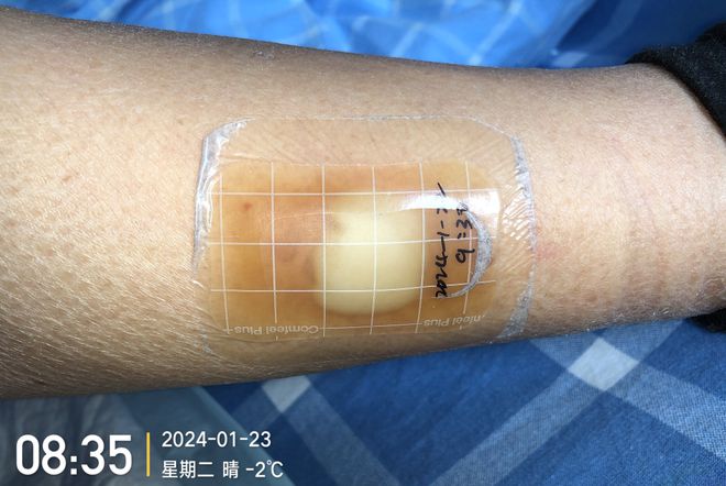 九游娱乐文化:敷贴固定小妙招伤口护理好帮手!果断收藏(图5)