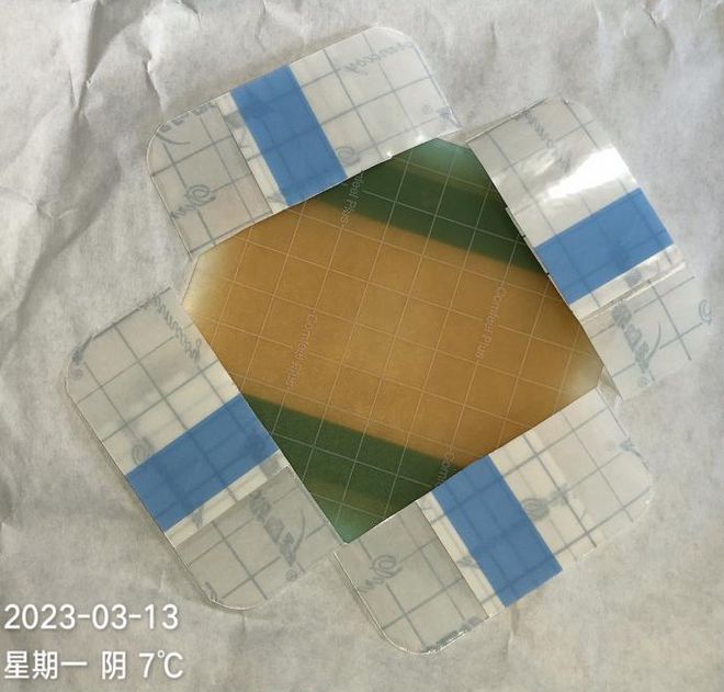 九游娱乐文化:敷贴固定小妙招伤口护理好帮手!果断收藏(图9)