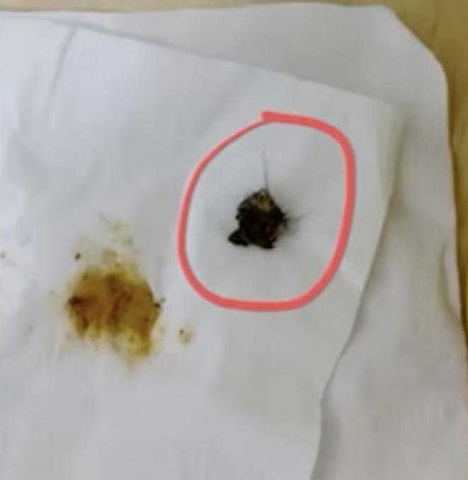 网友称豆瓣酱中吃出鼠头厂家回应：产品中不可能出现新鲜毛发(图3)