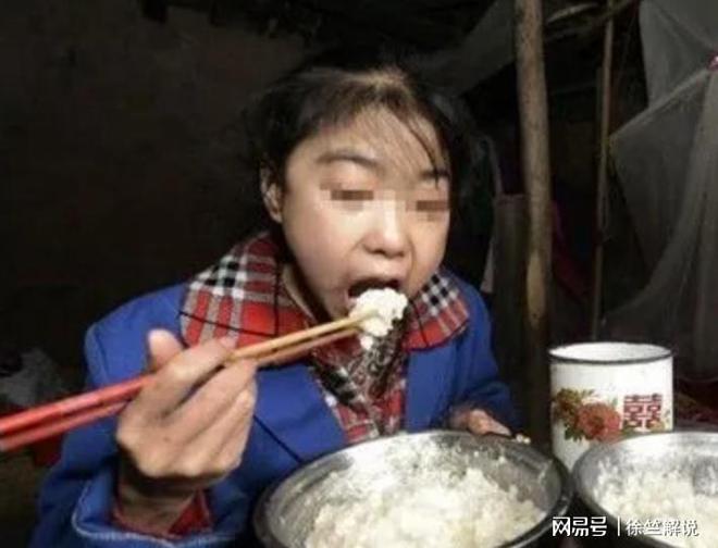 12岁重庆女孩每天吃8顿饭体重仅30公斤引发关注。(图3)
