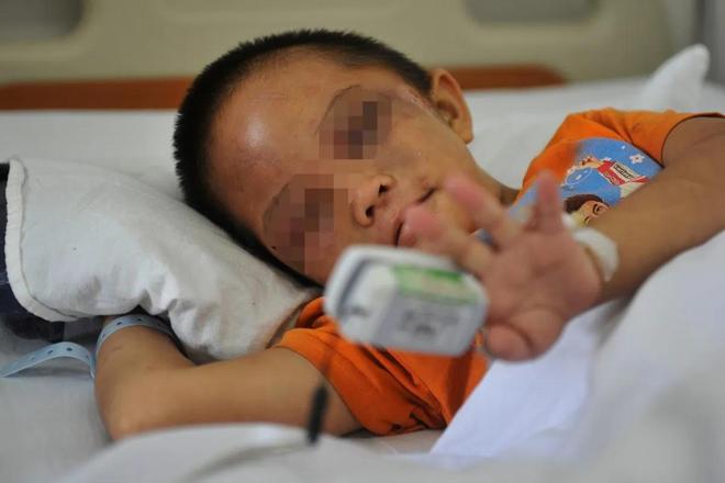 才六岁!2024年福建男童吃太多毒发时“青面獠牙”(图2)