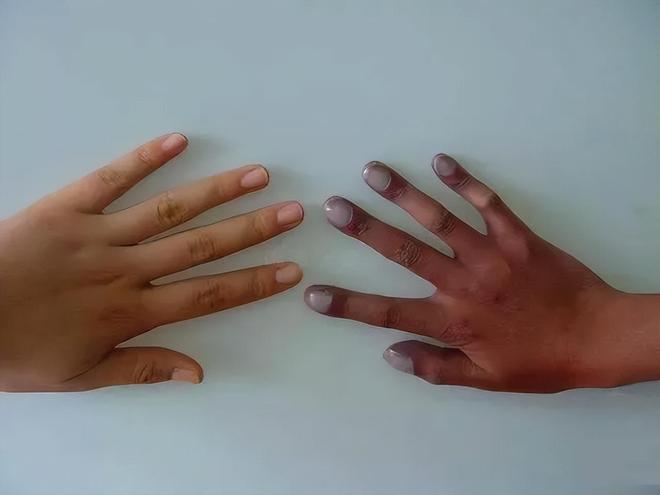 才六岁!2024年福建男童吃太多毒发时“青面獠牙”(图1)