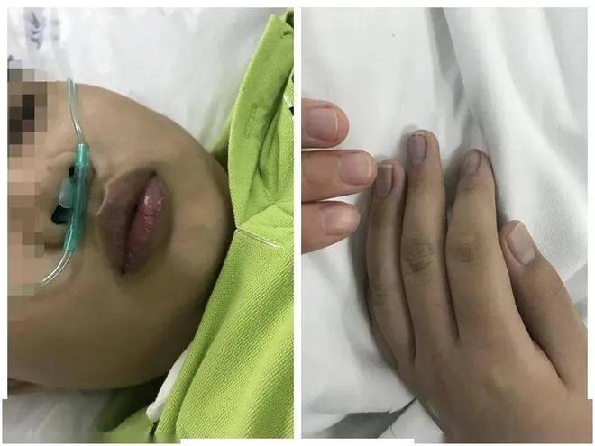 才六岁!2024年福建男童吃太多毒发时“青面獠牙”(图3)