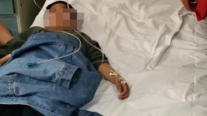 才六岁!2024年福建男童吃太多毒发时“青面獠牙”(图9)