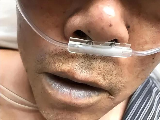 才六岁!2024年福建男童吃太多毒发时“青面獠牙”(图17)