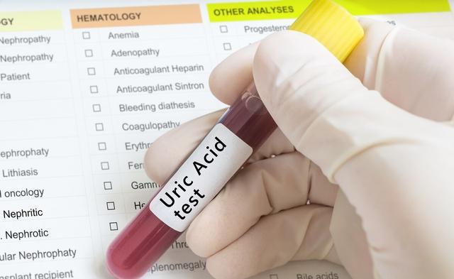 尿酸高的人别光少吃肉4种调料也要拉入黑名单以防痛风来袭(图1)