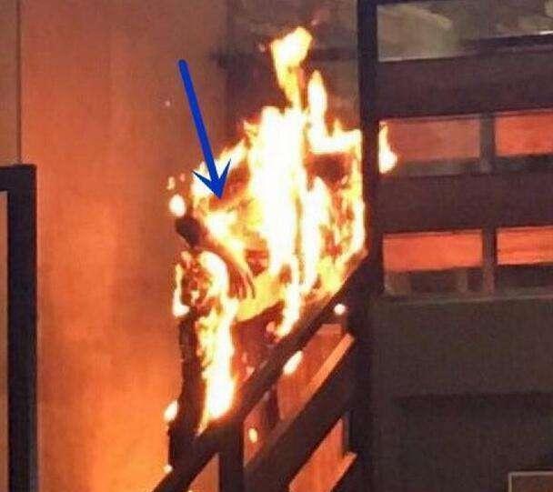 九游娱乐文化:2016年SNH唐安琪被烧伤差点丢了命唐安琪“是我自己不小心”(图3)