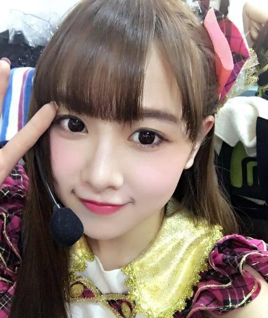 九游娱乐文化:2016年SNH唐安琪被烧伤差点丢了命唐安琪“是我自己不小心”(图2)