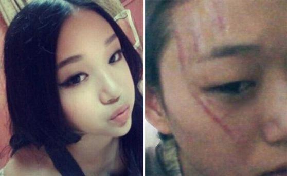 九游娱乐文化:2016年SNH唐安琪被烧伤差点丢了命唐安琪“是我自己不小心”(图5)